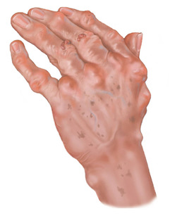 A hand with dark spots on the skin